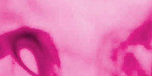 If you missed out on a dose of doxycycline take the next amount as quickly as you bear in mind.